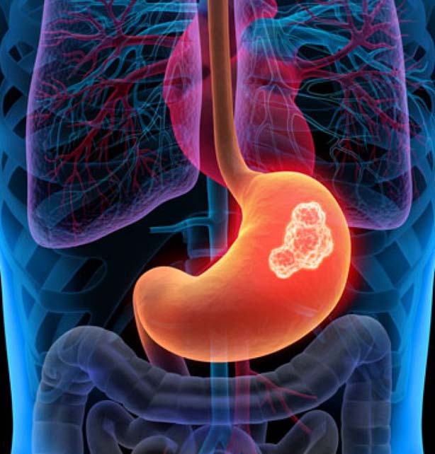 Gastrointestinales
